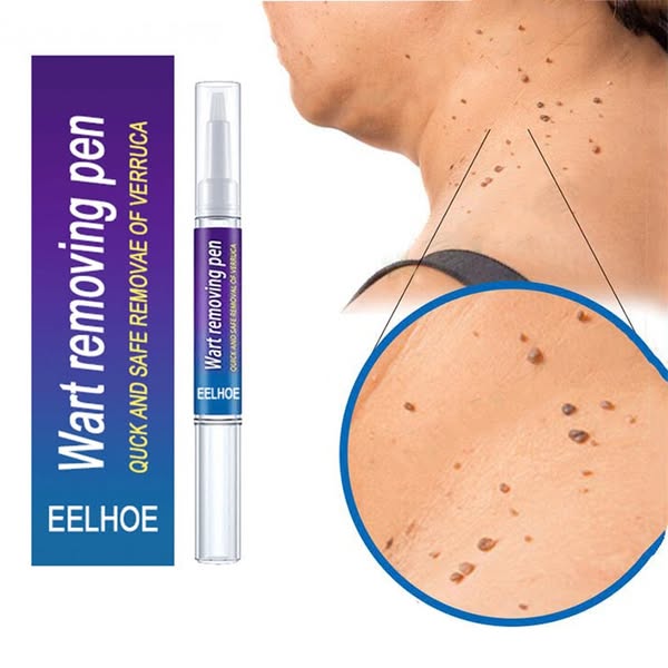 STYLO ANTI-ACROCHORDON au venin d'abeille