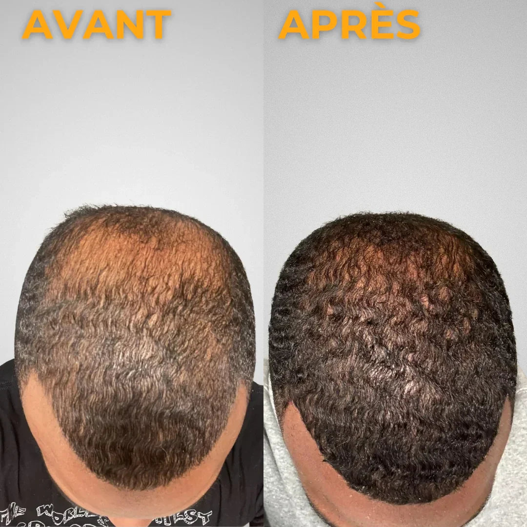 NATUREL HAIR OIL