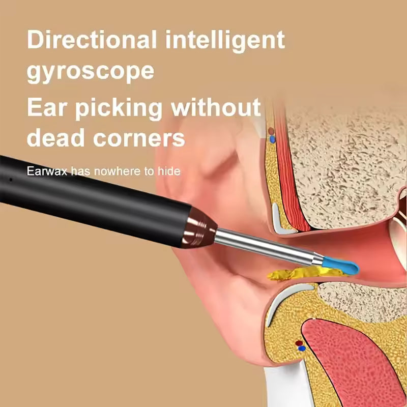 🦻 Nettoyeur d’Oreille Intelligent avec Caméra HD – Vision, Sécurité et Précision