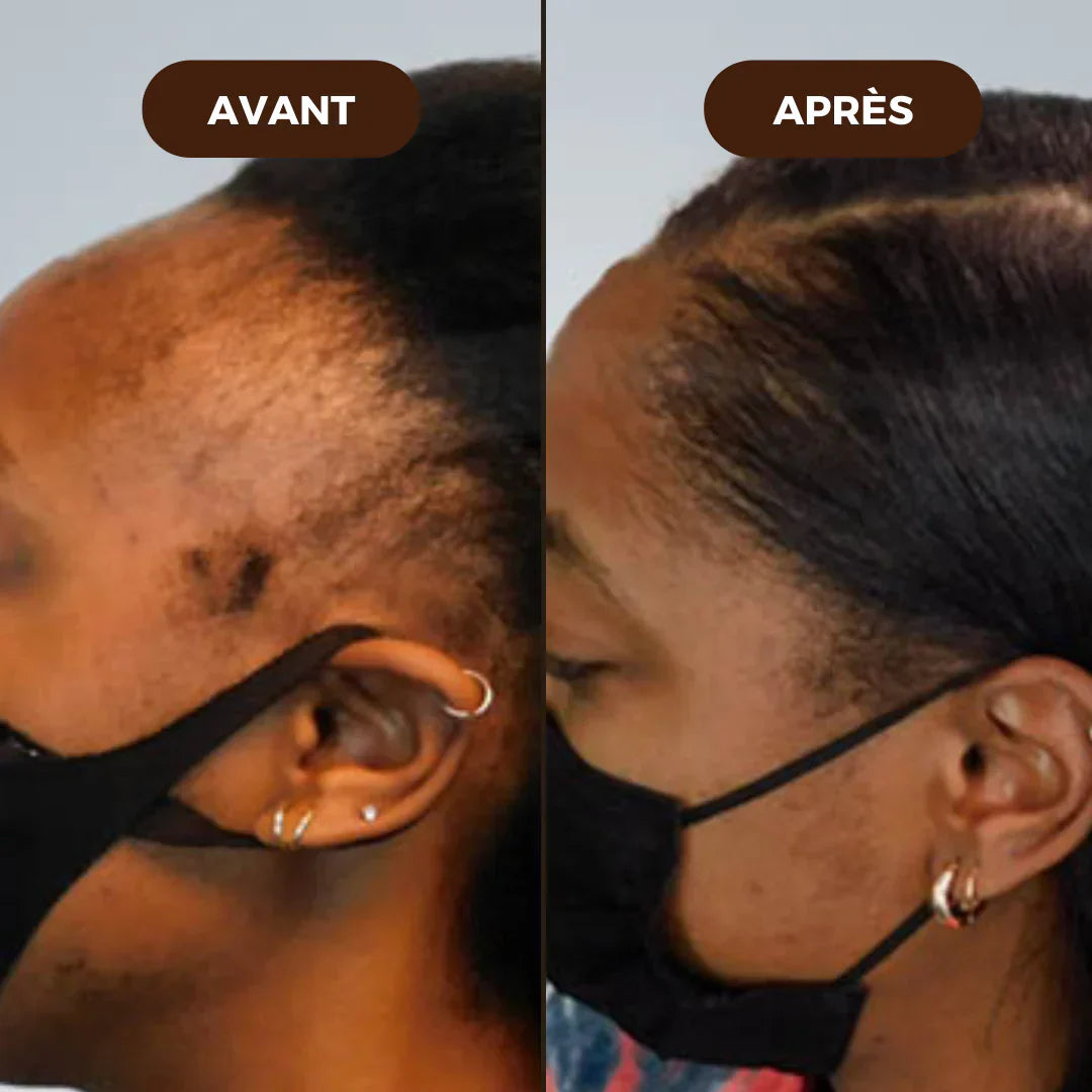 NATUREL HAIR OIL